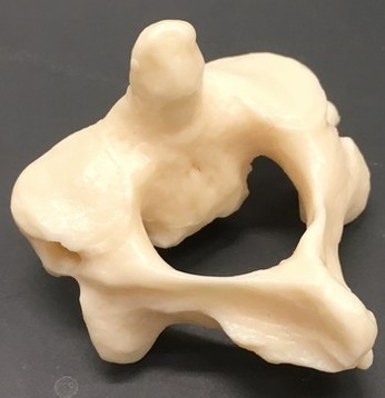 七つある首の骨〜その二番目、第二頸椎の位置を整える『頸部前彎療法』知ってます？？？
