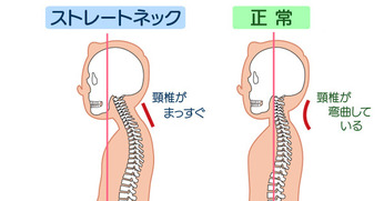 明日に架ける橋